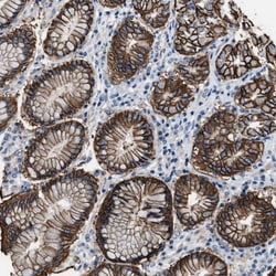 MUPP1 Antibody, Novus Biologicals 25 &mu;L; Unlabeled:Antibodies, Polyclonal