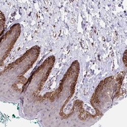 MURF2 Antibody, Novus Biologicals 25 &mu;L | Buy Online | Novus Biologicals | Fisher Scientific