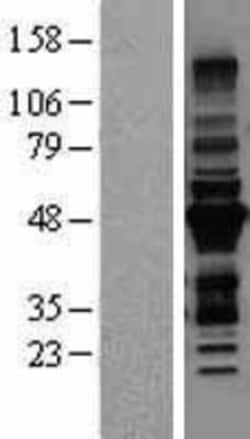Novus Biologicals™ MURF3 Overexpression Lysate