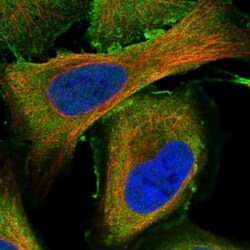 MURF3 Antibody, Novus Biologicals 0.1mL; Unlabeled:Antibodies, Polyclonal