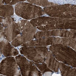 MURF3 Antibody, Novus Biologicals 0.1mL; Unlabeled:Antibodies, Polyclonal