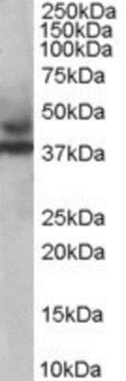 MURF3 Antibody, Novus Biologicals 0.1mg; Unlabeled:Antibodies, Polyclonal