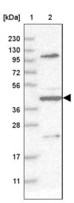 MURF3 Antibody, Novus Biologicals 0.1mL; Unlabeled:Antibodies, Polyclonal