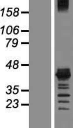 Novus Biologicals&trade;&nbsp;Musashi-1 Overexpression Lysate
