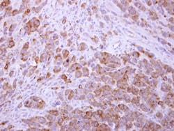 Musashi-2 Antibody, Novus Biologicals 0.1mL; Unlabeled:Antibodies, Polyclonal