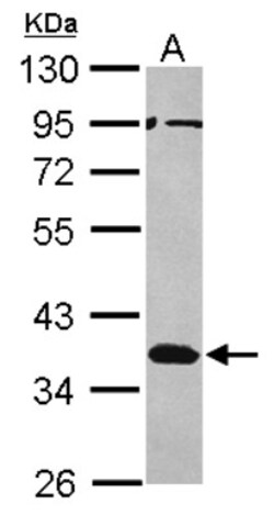 Musashi-2 Antibody, Novus Biologicals 0.1mL; Unlabeled:Antibodies, Polyclonal