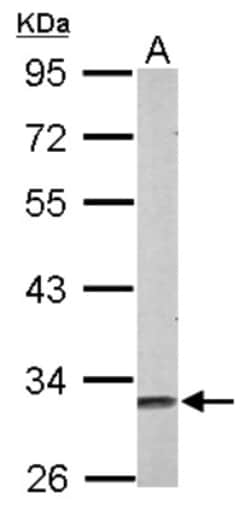 Musashi-2 Antibody, Novus Biologicals 0.1mL; Unlabeled:Antibodies, Polyclonal