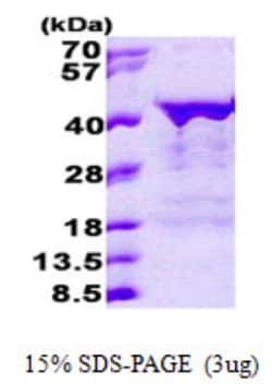 Novus Biologicals&trade;&nbsp;Recombinant Human Musashi-2 His Protein