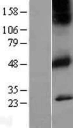 Novus Biologicals&trade;&nbsp;Muscarinic Acetylcholine Receptor M1/CHRM1 Overexpression Lysate
