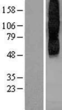 Novus Biologicals&trade;&nbsp;Muscarinic Acetylcholine Receptor M2/CHRM2 Overexpression Lysate