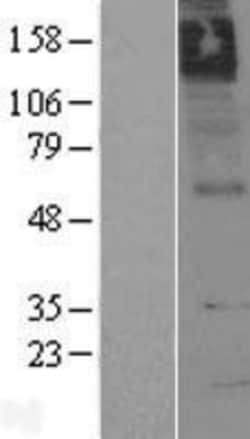 Novus Biologicals&trade;&nbsp;Muscarinic Acetylcholine Receptor M5/CHRM5 Overexpression Lysate