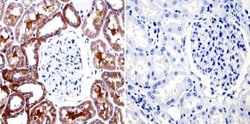 Muscarinic Acetylcholine Receptor M2/CHRM2 Antibody (31-1D1), Novus Biologicals