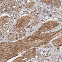 Muscarinic Acetylcholine Receptor M3/CHRM3 Antibody, Novus Biologicals:Antibodies:Primary