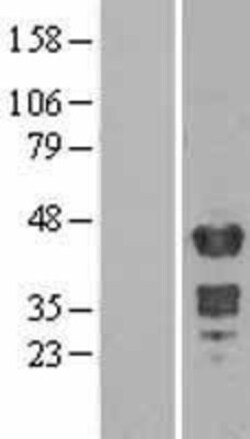 Novus Biologicals&trade;&nbsp;Muscleblind-like 1 Overexpression Lysate