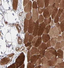 Muscle Phosphofructokinase/PFKM/PFK-1 Antibody, Novus Biologicals 0.1mL;