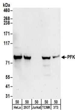Muscle Phosphofructokinase/PFKM/PFK-1 Antibody, Novus Biologicals 0.1mg;