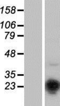 Novus Biologicals&trade;&nbsp;Musculin Overexpression Lysate