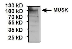 MuSK Antibody, Novus Biologicals 0.2mL; Unlabeled:Antibodies, Polyclonal