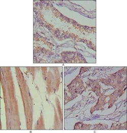MuSK Antibody (10A4), Novus Biologicals 0.1mL; Unlabeled:Antibodies, Monoclonal