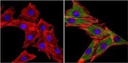 MuSK Antibody, Novus Biologicals 0.2mL; Unlabeled:Antibodies, Polyclonal