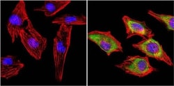 MuSK Antibody, Novus Biologicals 0.2mL; Unlabeled:Antibodies, Polyclonal