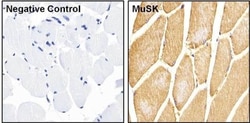 MuSK Antibody, Novus Biologicals 0.2mL; Unlabeled:Antibodies, Polyclonal