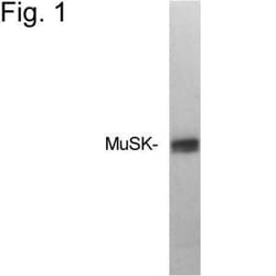 MuSK Antibody, Novus Biologicals 0.2mL; Unlabeled:Antibodies, Polyclonal