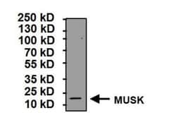 MuSK Antibody, Novus Biologicals 0.2mL; Unlabeled:Antibodies, Polyclonal