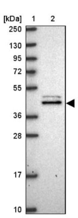 MVD Antibody, Novus Biologicals:Antibodies:Primary Antibodies