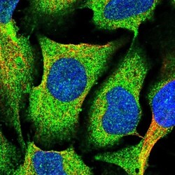 MVD Antibody, Novus Biologicals:Antibodies:Primary Antibodies