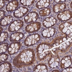 MVD Antibody, Novus Biologicals:Antibodies:Primary Antibodies