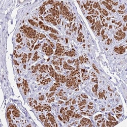 MVD Antibody, Novus Biologicals:Antibodies:Primary Antibodies