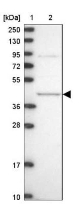 MVD Antibody, Novus Biologicals:Antibodies:Primary Antibodies