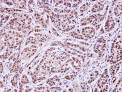 MVK Antibody, Novus Biologicals 0.1mg; Unlabeled:Antibodies, Polyclonal