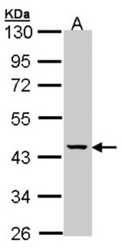 MVK Antibody, Novus Biologicals 0.1mg; Unlabeled:Antibodies, Polyclonal