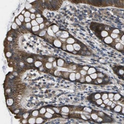 MVK Antibody, Novus Biologicals 0.1mL; Unlabeled:Antibodies, Polyclonal