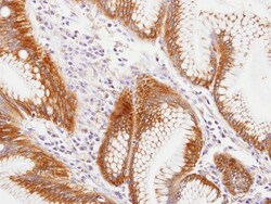 MVP Antibody, Novus Biologicals 0.1mg; Unlabeled:Antibodies, Polyclonal