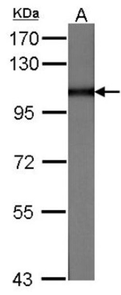 MVP Antibody, Novus Biologicals 0.1mg; Unlabeled:Antibodies, Polyclonal