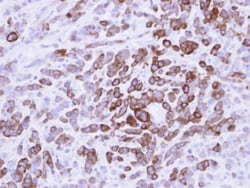 MxA/Mx1 Antibody, Novus Biologicals 0.1mg; Unlabeled:Antikörper