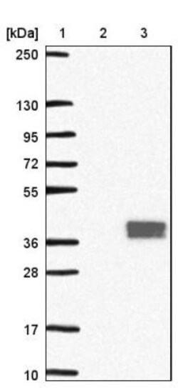 Mxi1 Antibody, Novus Biologicals 25 &mu;L | Buy Online | Novus Biologicals | Fisher Scientific