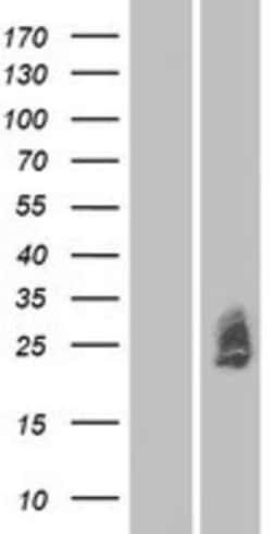 Novus Biologicals™ MXRA7 Overexpression Lysate