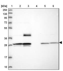 MXRA7 Antibody, Novus Biologicals:Antibodies:Primary Antibodies