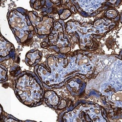 MYADML2 Antibody, Novus Biologicals 0.1mL; Unlabeled:Antibodies, Polyclonal