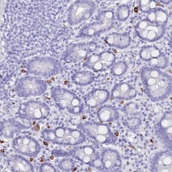 MYADML2 Antibody, Novus Biologicals 0.1mL; Unlabeled:Antibodies, Polyclonal