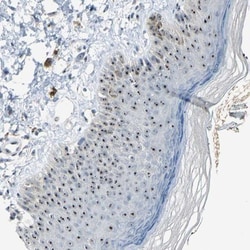 MYBBP1A Antibody, Novus Biologicals:Antibodies:Primary Antibodies