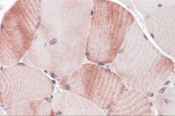 MYBPC1 Antibody - BSA Free, Novus Biologicals 0.1mg; Unlabeled:Antibodies,
