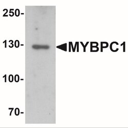 MYBPC1 Antibody - BSA Free, Novus Biologicals:Antibodies:Primary Antibodies