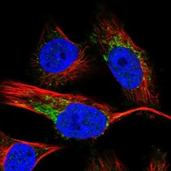 MyBPC3 Antibody, Novus Biologicals:Antibodies:Primary Antibodies