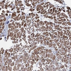 MyBPC3 Antibody, Novus Biologicals:Antibodies:Primary Antibodies