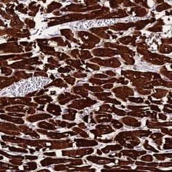 MyBPC3 Antibody, Novus Biologicals 0.1mL; Unlabeled:Antibodies, Polyclonal